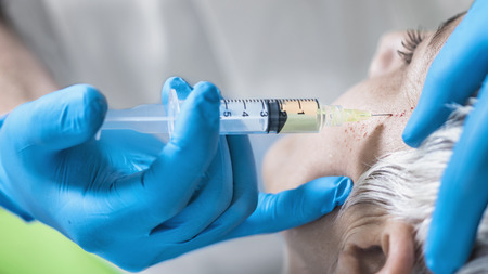 PRP Face Cosmetics Injecting. Beautiful mature woman receives Platelet Rich Plasma face injection treatment for reducing wrinkles. Anti-aging concept.の写真素材