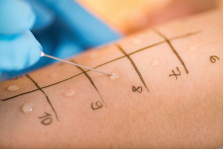 Immunologist Doing Skin Prick Allergy Test on a Womanâ€™s Arm