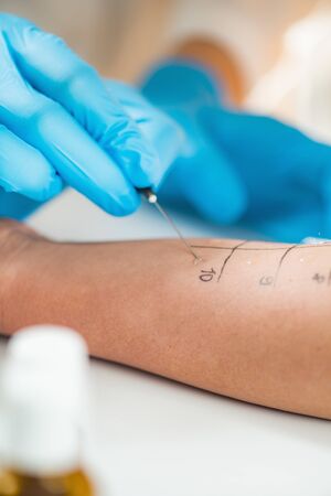 Immunologist Doing Skin Prick Allergy Test on a Womanâ€™s Arm