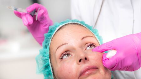 Anti-Aging Treatment. Hyaluronic injectionの写真素材
