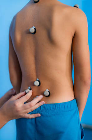 Placing markers for 3D posture analysis of children, photometric methodの写真素材