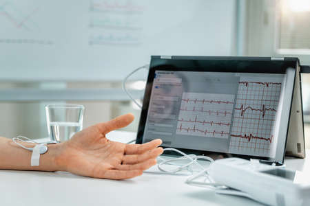 Biofeedback - female hand with attached sensors for heart rate measurement. Biofeedback is a...