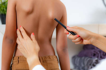 Pediatric doctor examining posture of a boy, making marks on his back, checking angle of scapula bones.の写真素材