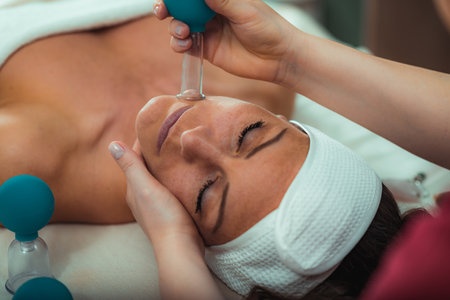 Cupping therapy, ventosa cupping face treatment in a beauty salonの写真素材