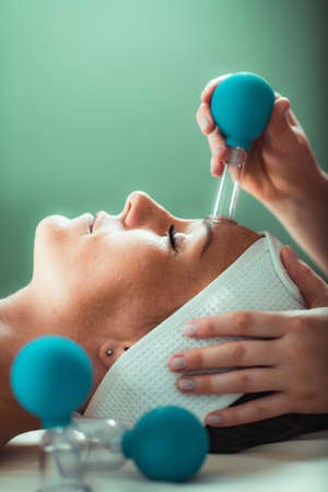 Cupping therapy, ventosa cupping face treatment in a beauty salonの写真素材