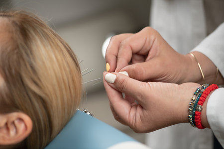 Acupuncturist stimulating Bai Hui point to improve patient concentration and memoryの写真素材