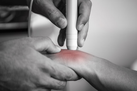Physical therapist performs laser therapy on a patients wrist, targeting pain relief and promoting healing in a clinical settingの写真素材