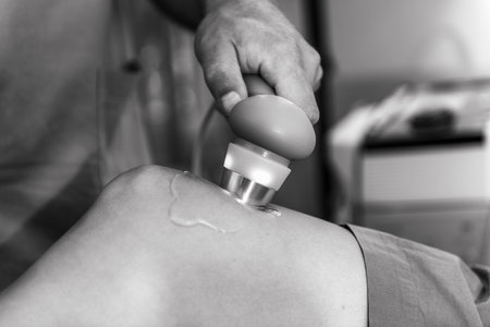Physical therapist applies ultrasound therapy to a patient's knee, targeting pain relief and improving recovery in a clinical environmentの写真素材