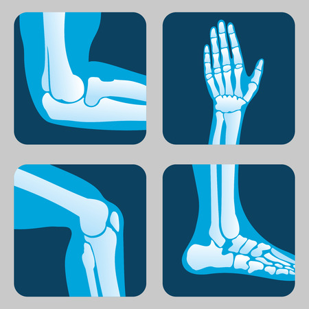 Medical orthopedic vector of set.のイラスト素材