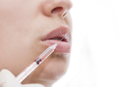 young woman gets injection in her lips. Woman in beauty salon. plastic surgery clinic.の写真素材