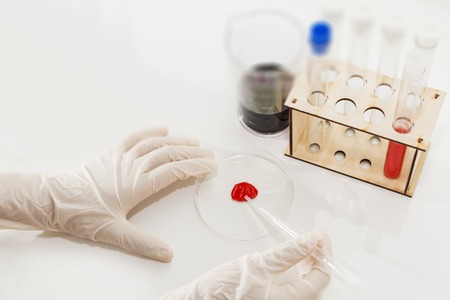 the medical doctors hand works with a sample of blood, vial and flask.の写真素材