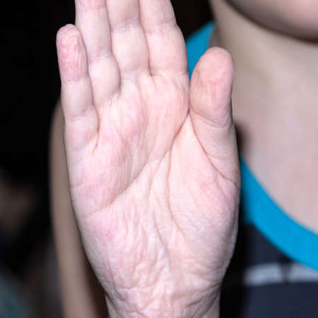 The childs hand in wrinkles after bathing.