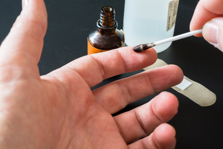 Treatment of Fingers with Iodine. Flacon Filled With Iodineの写真素材