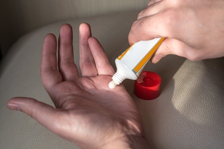 Ointment on hand. Man applying the ointment from the tube.
