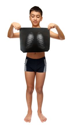 boy with x-ray image of breast cage isolated on whiteの写真素材