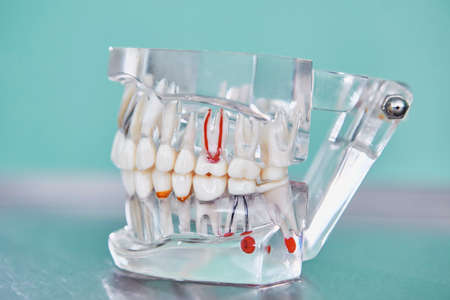 Transparent Model of a human jaw. Oral dental hygiene concept. Dental dentistry students teaching model showing teeth, roots, gums, gum disease, caries and plaque.の写真素材