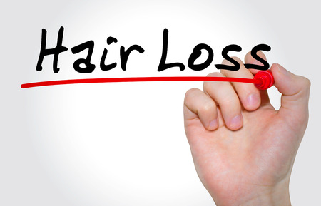 Hand writing inscription Hair Loss with marker, conceptの写真素材