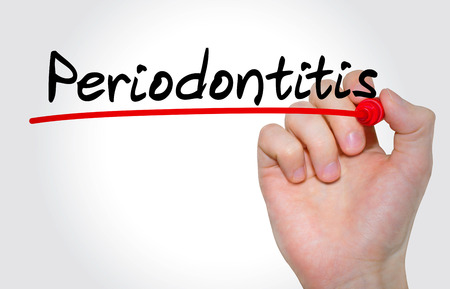 Hand writing inscription Periodontitis with marker, conceptの写真素材