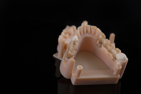 Tooth human implant. Dental concept. Ceramic human teeth or dentures. Implants on black background closeupの写真素材