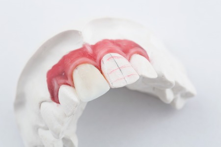 detail dental wax model ower white background