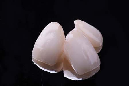 dental ceramic veneers and crownsの写真素材