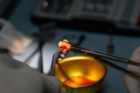 close up implant dentist work operation