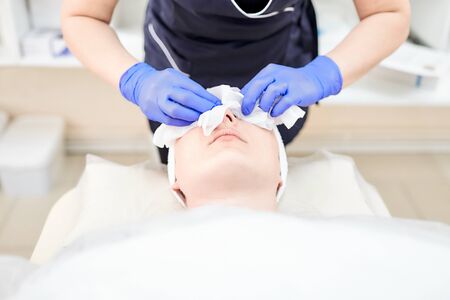 The process of removal a cosmetic cream from the face of a young woman. Hands of the cosmetologist in gloves. Facial skin care. Peelingの写真素材