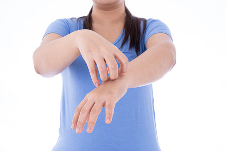Female scratching her hand on isolated white background. Medical, healthcare for advertising...