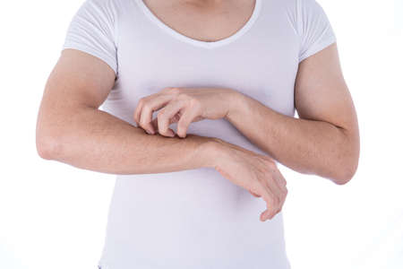 Male scratching his arm on isolated white background. Medical, healthcare for advertising concept.のeditorial素材