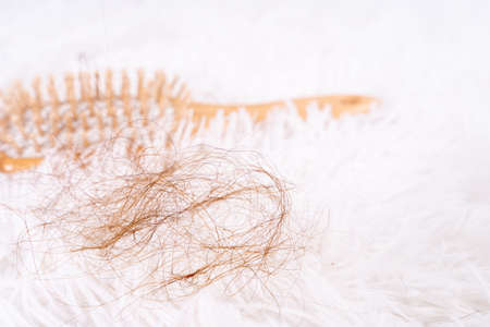 Hair fall problem, closeup comb and problem hair. Healthcare medical or daily life concept.の写真素材