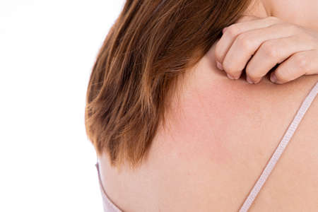 Female scratching her back isolated white background. Medical, healthcare for advertising concept.の写真素材
