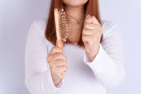 Hair fall problem, closeup hand holding comb and problem hair. Healthcare medical or daily life concept.の写真素材