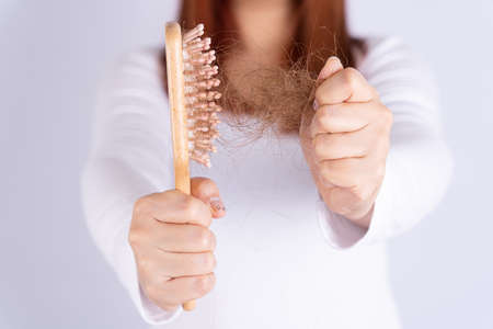 Hair fall problem, closeup hand holding comb and problem hair. Healthcare medical or daily life concept.の写真素材