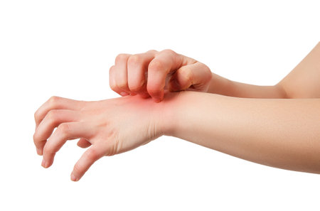 Woman has skin rash itch on arm isolated on white