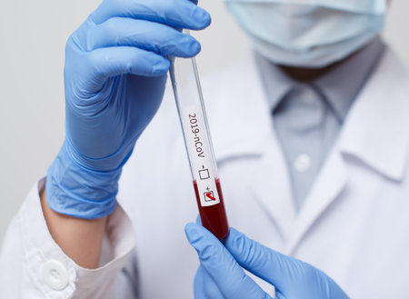 Blood test tube in doctor hand, Mers-CoV Coronavirus test Positive label in hospital blood test tube...
