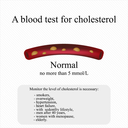 A blood test for cholesterol. Infographics. のイラスト素材