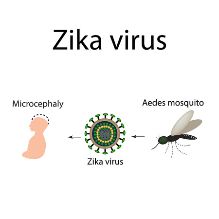 Zika virus. Mosquito bite. Microcephaly in the infant. Infographics. illustration.のイラスト素材