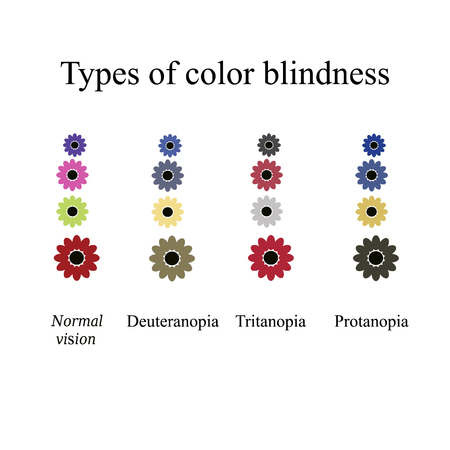 Types of color blindness. Eye color perception. illustration on isolated background.のイラスト素材