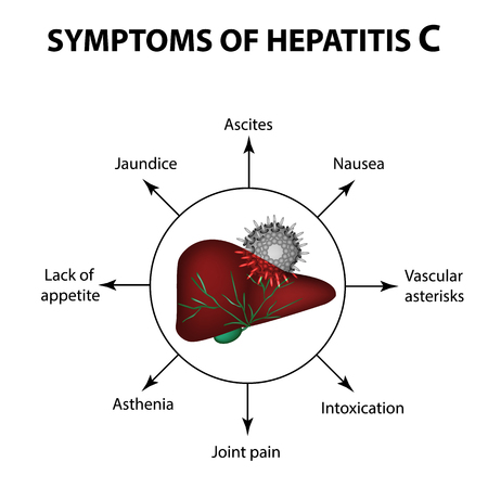 Symptoms of hepatitis C.のイラスト素材