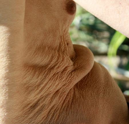 Flabby skin. Skin fold on the abdomen and chest. Stretched mammary gland after feedingの写真素材
