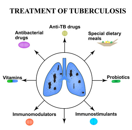 Treatment of tuberculosis. World Tuberculosis Day. March 24. Medicines, tablets, capsules. The structure of the lungs. Info-graphics, vector illustration on isolated background.のイラスト素材