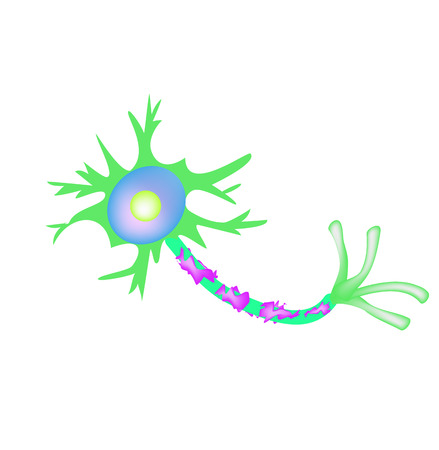 The destruction of the myelin sheath on the axon. Damaged myelin. Neuron affected by multiple sclerosis. World Multiple Sclerosis Day. Infographics. Vector illustration on isolated backgroundのイラスト素材