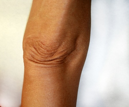 Wrinkles and creases on his elbow. Old wrinkled elbowの写真素材