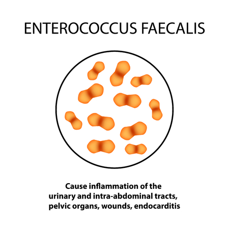 Enterococcus faecalis. Pathogenic flora. The bacterium causes intestinal diseases. Infographics. Vector illustration.のイラスト素材