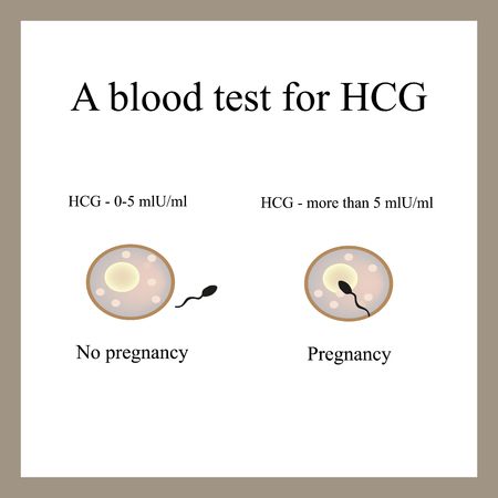 blood test for hCG. The pregnancy. fertilized egg. Infographicsのイラスト素材