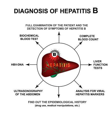 Diagnosis of hepatitis B. World Hepatitis Day. Infographics. Vector illustration on isolated backgroundのイラスト素材