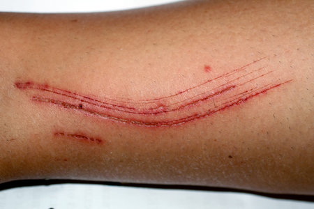 Large cut on the leg. Skin abrasion.の写真素材