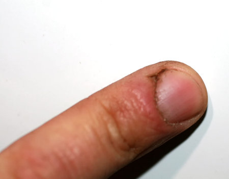 Crack on the thumb. Burr and dirt on the skin. The hand of the working man