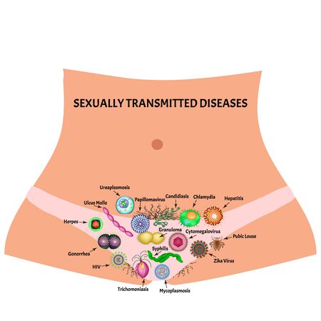 Viral and bacterial infections. Sexually transmitted diseases. Infographics. Vector illustration on isolated background.のイラスト素材
