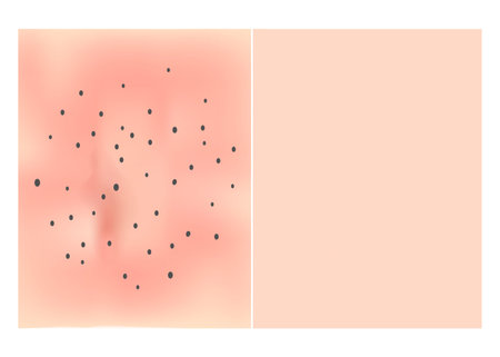 Skin texture with black dots of acne. Before After acne. Skin background. Infographics. Vector illustrationのイラスト素材